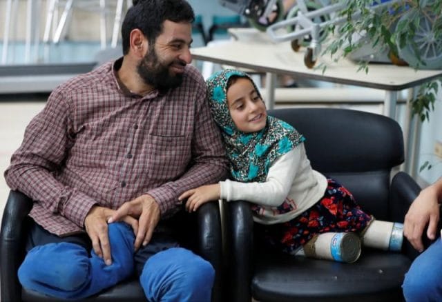 Ông Mohamed Merhi, bố của bé, cũng bị mắc chứng bệnh bẩm sinh giống con gái mình.